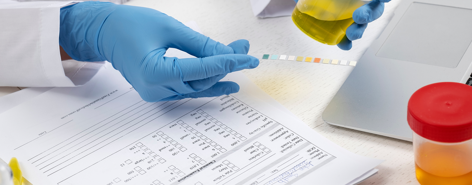 Understanding How Rapid Drug Test Kits Work