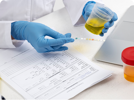 Understanding How Rapid Drug Test Kits Work